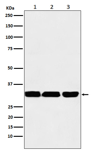 1 - Anti-p53 DINP1 Rabbit Monoclonal Antibody ABO15352