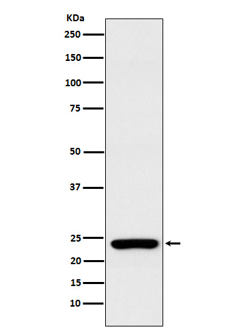 1 - Anti-Rab25 Rabbit Monoclonal Antibody ABO15353