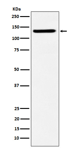 1 - Anti-SF3B3 Rabbit Monoclonal Antibody ABO15354