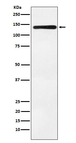 1 - Anti-Bub1 Rabbit Monoclonal Antibody ABO15356