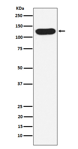 1 - Anti-Nicastrin Rabbit Monoclonal Antibody ABO15357