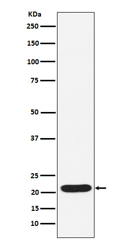 1 - Anti-SOCS2 Rabbit Monoclonal Antibody ABO15359