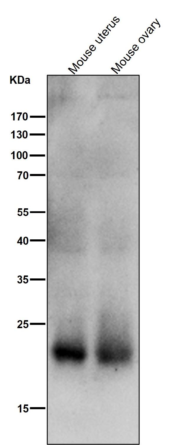 1 - Anti-SOCS2 Rabbit Monoclonal Antibody ABO15359