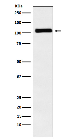 1 - Anti-MIB1 / DIP1 Rabbit Monoclonal Antibody ABO15362