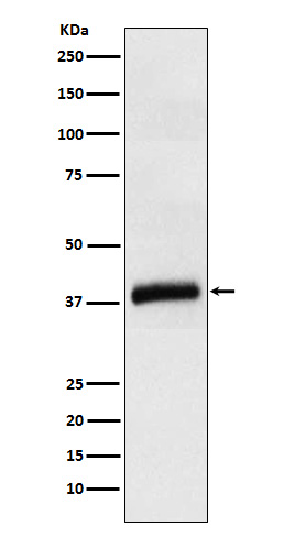 1 - Anti-APOL1 Rabbit Monoclonal Antibody ABO15363