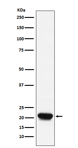 1 - Anti-RHEB Rabbit Monoclonal Antibody ABO15364