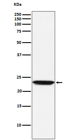 1 - Anti-Tetranectin Rabbit Monoclonal Antibody ABO15365