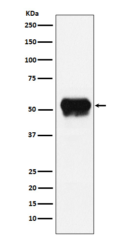 1 - Anti-Fibrinogen gamma chain Rabbit Monoclonal Antibody ABO15366