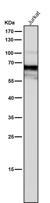 1 - Anti-Yes1 Rabbit Monoclonal Antibody ABO15368