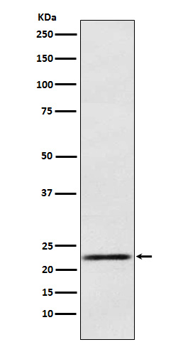1 - Anti-Prolactin Rabbit Monoclonal Antibody ABO15370