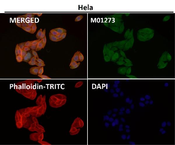 1 - Anti-LIS1 Rabbit Monoclonal Antibody ABO15372