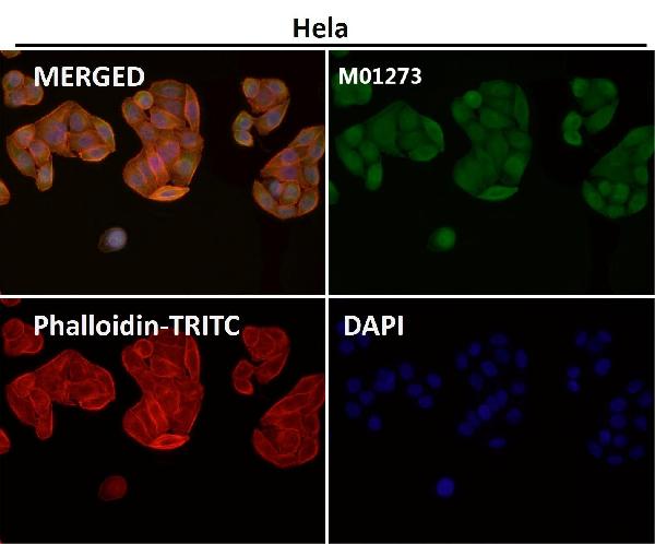 1 - Anti-LIS1 Rabbit Monoclonal Antibody ABO15372