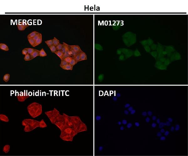 1 - Anti-LIS1 Rabbit Monoclonal Antibody ABO15372