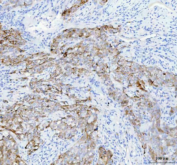2 - Anti-IGFBP2 Rabbit Monoclonal Antibody ABO15373