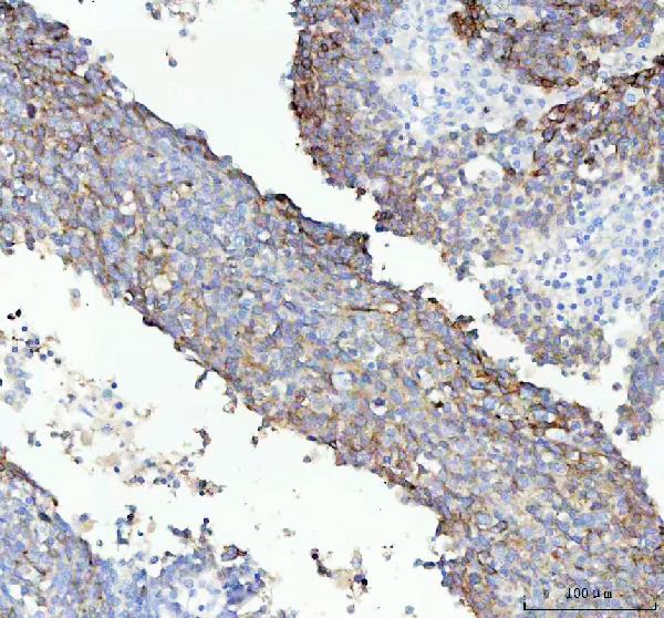 2 - Anti-IGFBP2 Rabbit Monoclonal Antibody ABO15373