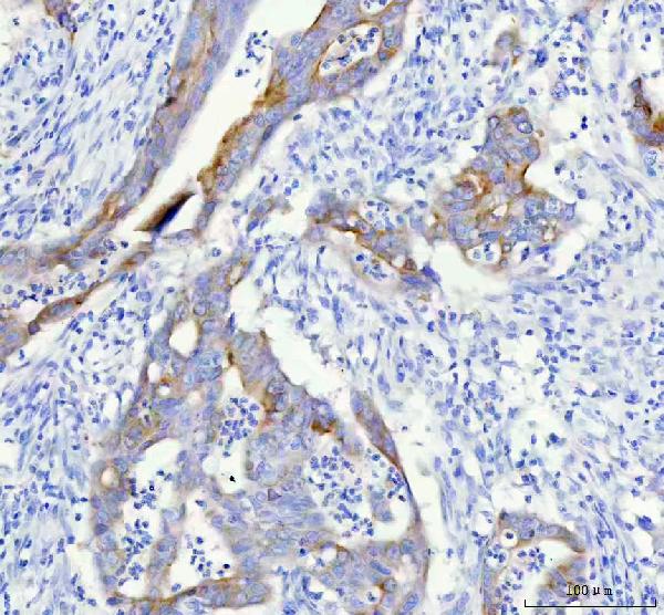 2 - Anti-IGFBP2 Rabbit Monoclonal Antibody ABO15373