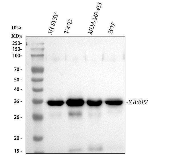 1 - Anti-IGFBP2 Rabbit Monoclonal Antibody ABO15373