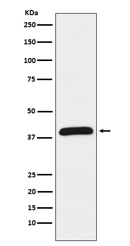 1 - Anti-HIF1AN Rabbit Monoclonal Antibody ABO15376