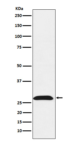 1 - Anti-RhoGDI Rabbit Monoclonal Antibody ABO15378