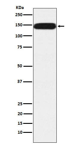 1 - Anti-Pumilio 1 Rabbit Monoclonal Antibody ABO15379