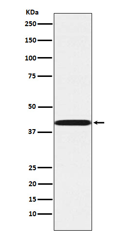 1 - Anti-P2Y6 Rabbit Monoclonal Antibody ABO15380