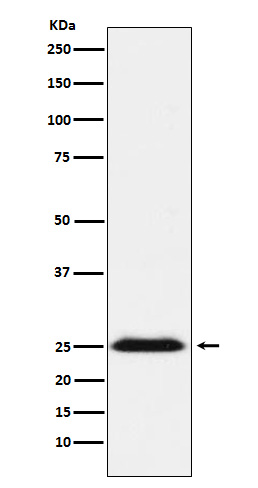 1 - Anti-BAP31 Rabbit Monoclonal Antibody ABO15382