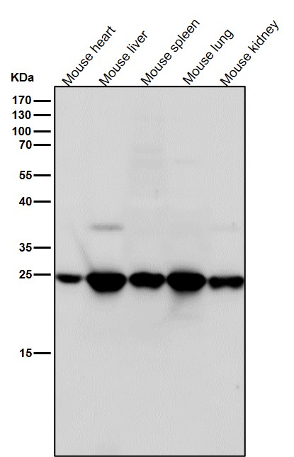 1 - Anti-BAP31 Rabbit Monoclonal Antibody ABO15382