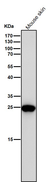 1 - Anti-BAP31 Rabbit Monoclonal Antibody ABO15382