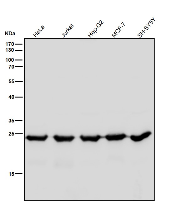 1 - Anti-BAP31 Rabbit Monoclonal Antibody ABO15382