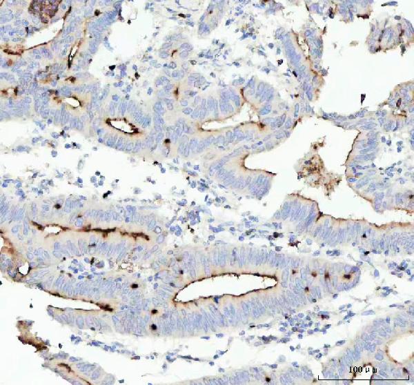 2 - Anti-CEACAM1 Rabbit Monoclonal Antibody ABO15387