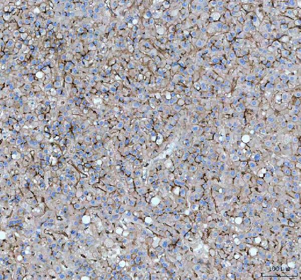 2 - Anti-CEACAM1 Rabbit Monoclonal Antibody ABO15387