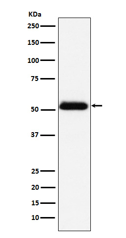 1 - Anti-Prostatic Acid Phosphatase Rabbit Monoclonal Antibody ABO15388