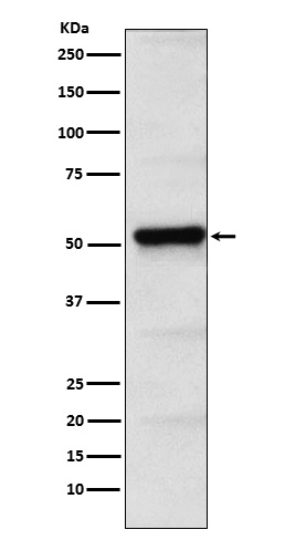 1 - Anti-PICK1 Rabbit Monoclonal Antibody ABO15390