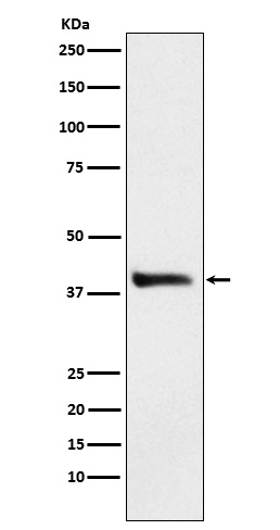 1 - Anti-Alcohol Dehydrogenase Rabbit Monoclonal Antibody ABO15396
