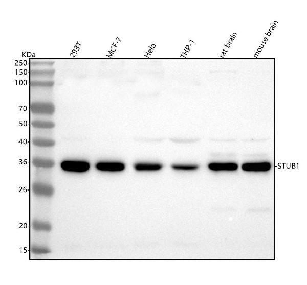 1 - Anti-STUB1 Rabbit Monoclonal Antibody ABO15397