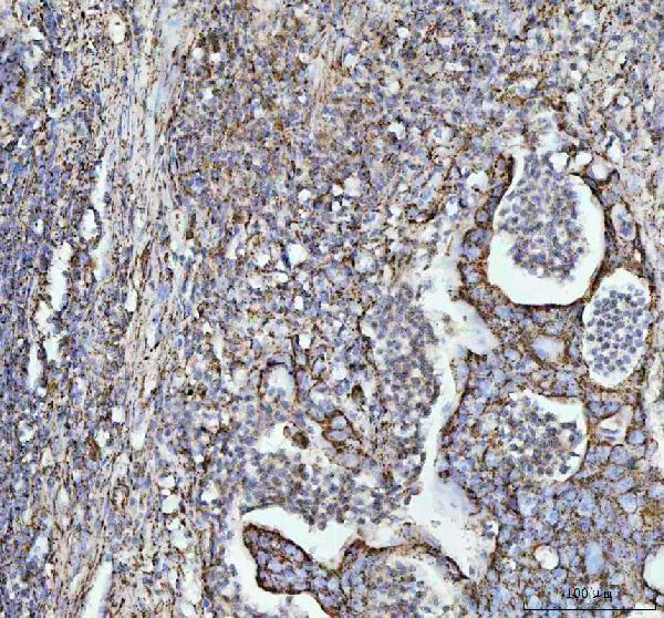 2 - Anti-HSP10 Rabbit Monoclonal Antibody ABO15399