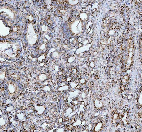 2 - Anti-HSP10 Rabbit Monoclonal Antibody ABO15399