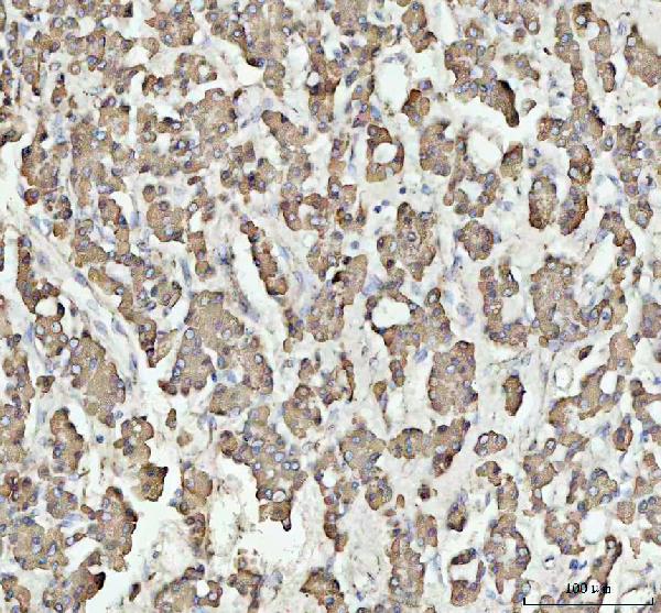 2 - Anti-HSP10 Rabbit Monoclonal Antibody ABO15399