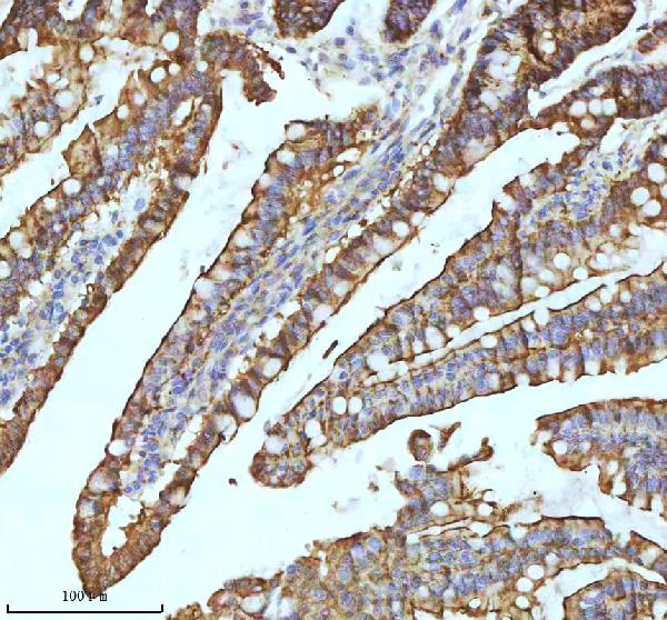 2 - Anti-Xanthine Oxidase Rabbit Monoclonal Antibody ABO15402
