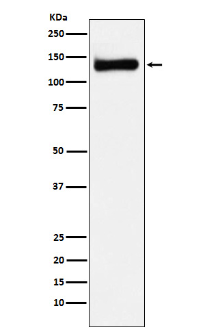 1 - Anti-RENT1 / hUPF1 Rabbit Monoclonal Antibody ABO15404