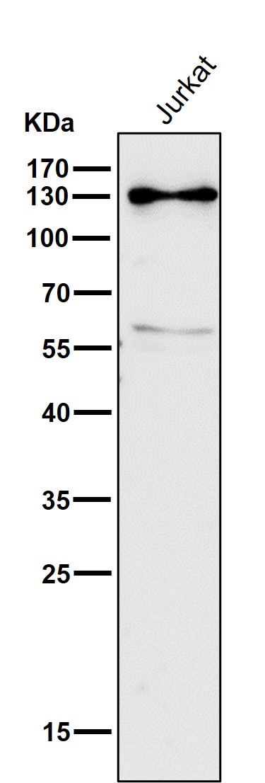 1 - Anti-RENT1 / hUPF1 Rabbit Monoclonal Antibody ABO15404