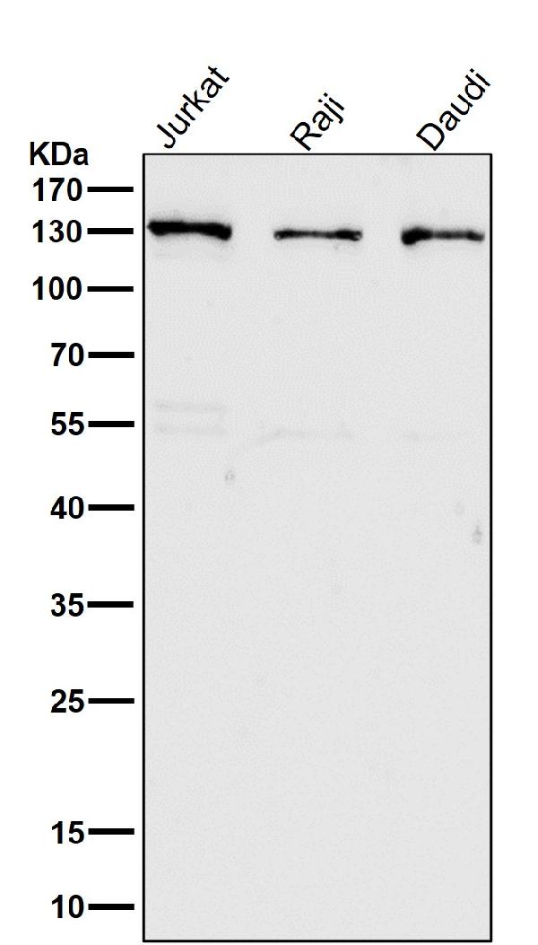 1 - Anti-RENT1 / hUPF1 Rabbit Monoclonal Antibody ABO15404
