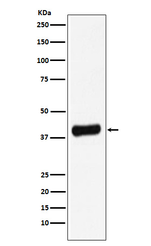 1 - Anti-Galectin 8 Rabbit Monoclonal Antibody ABO15407