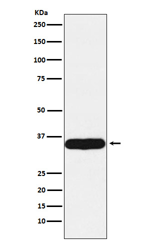1 - Anti-Tropomyosin 1 Rabbit Monoclonal Antibody ABO15410