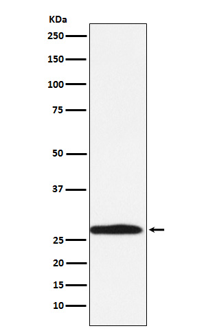 1 - Anti-Carbonic Anhydrase 1 Rabbit Monoclonal Antibody ABO15413