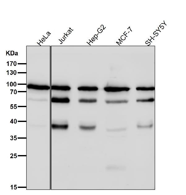 1 - Anti-TNPO3 Rabbit Monoclonal Antibody ABO15415