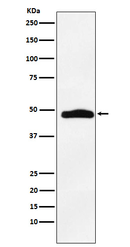 1 - Anti-MAPKAP Kinase 2 Rabbit Monoclonal Antibody ABO15418