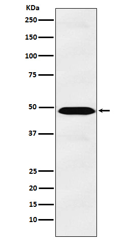 1 - Anti-IL13 receptor alpha 1 Rabbit Monoclonal Antibody ABO15419