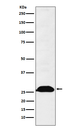 1 - Anti-Human Kappa Chain Rabbit Monoclonal Antibody ABO15420