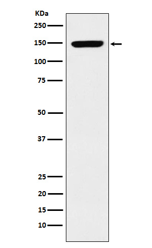 1 - Anti-p150 CAF1 Rabbit Monoclonal Antibody ABO15421